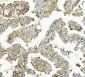 Anti-Hexokinase 1/HK1 Antibody Picoband™ (monoclonal, 4B7)
